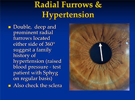 Iris Analysis