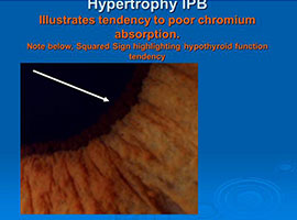 Iris Analysis