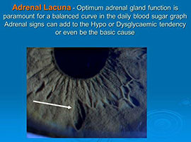 Iris Analysis