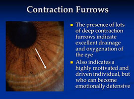 Iris Analysis