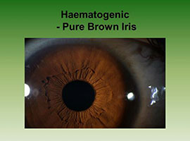 Iris Analysis