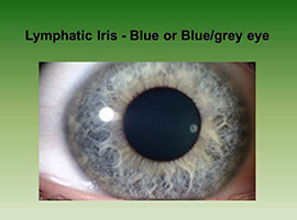 Iris Analysis