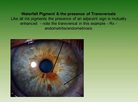 Iris Analysis